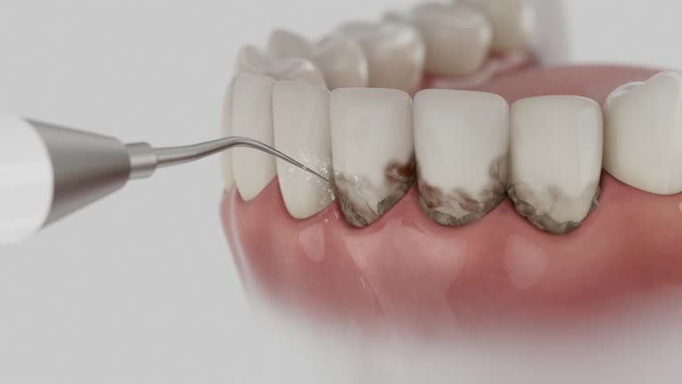 Trusted Dental Implants service in Pryor Creek, OK - Dentist Open Now